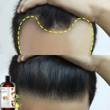 Zencefil Bitkisel Şampuan Saç Büyüme Anti-saç Dökülmesi Anti-kaşıntı kepek Önleyici Yağ kontrol Ferahlatıcı Kontrol